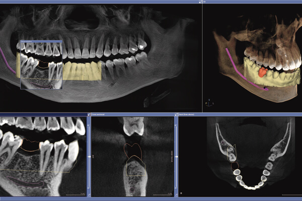 ORTHOPHOS XG 3D Clínica Dental Ozores O Grove